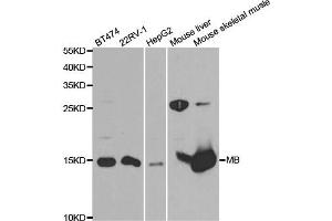 Western Blotting (WB) image for anti-MB antibody (ABIN1876659) (MB anticorps)