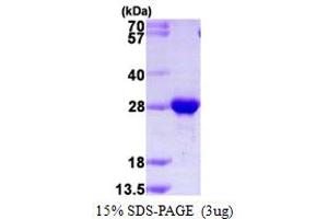 SDS-PAGE (SDS) image for RAB2B, Member RAS Oncogene Family (RAB2B) (AA 1-216) protein (His tag) (ABIN667645) (RAB2B Protein (AA 1-216) (His tag))