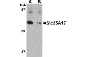 Western Blotting (WB) image for anti-Solute Carrier Family 22 (Organic Cation Transporter), Member 17 (SLC22A17) (C-Term) antibody (ABIN1030674)