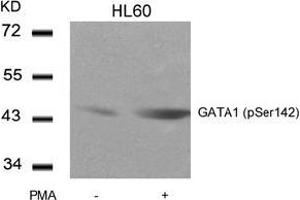Image no. 3 for anti-GATA Binding Protein 1 (Globin Transcription Factor 1) (GATA1) (pSer142) antibody (ABIN196684) (GATA1 anticorps  (pSer142))