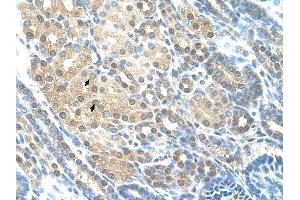 RAD23A antibody was used for immunohistochemistry at a concentration of 4-8 ug/ml to stain Epithelial cells of renal tubule (arrows) in Human Kidney. (RAD23A anticorps)