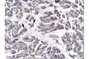 Image no. 1 for anti-General Transcription Factor IIH, Polypeptide 3, 34kD (GTF2H3) (AA 59-108) antibody (ABIN6735772)