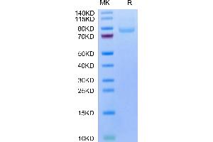 SDS-PAGE (SDS) image for Leucine Rich Repeat Containing 15 (LRRC15) protein (His-Avi Tag) (ABIN7275215)