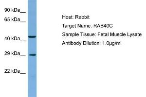 Host: Rabbit Target Name: RAB40C Sample Type: Fetal Muscle lysates Antibody Dilution: 1. (RAB40C anticorps  (C-Term))