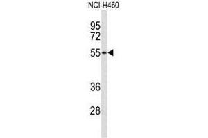 Western blot analysis of ACCN1 Antibody (Center) in NCI-H460 cell line lysates (35 µg/lane). (ACCN1 anticorps  (Middle Region))