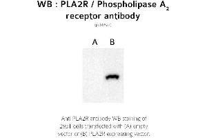 Image no. 1 for anti-phospholipase A2 Receptor 1, 180kDa (PLA2R1) (C-Term) antibody (ABIN347711) (PLA2R1 anticorps  (C-Term))