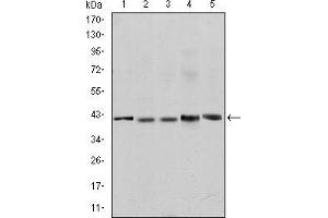 Western blot analysis using c-Rel mouse mAb against Jurkat (1), NIH/3T3 (2), Hela (3), HEK293 (4) and RAJI (5) cell lysate. (c-Rel anticorps)