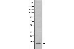 Western blot analysis of extracts from A549 cells using RPL30 antibody. (RPL30 anticorps  (C-Term))