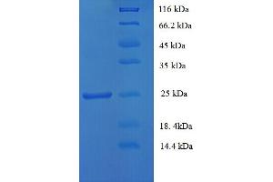 SDS-PAGE (SDS) image for CD81 (CD81) (AA 113-201) protein (His-SUMO Tag) (ABIN5709249)