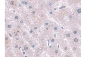 Detection of SPINT2 in Human Liver Tissue using Polyclonal Antibody to Serine Peptidase Inhibitor Kunitz Type 2 (SPINT2)
