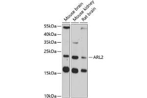 Western blot analysis of extracts of various cell lines, using  antibody (ABIN3016794, ABIN3016795, ABIN3016796 and ABIN6219841) at 1:3000 dilution. (ARL2 anticorps  (AA 1-184))