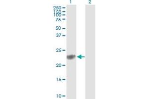 Western Blot analysis of GSTP1 expression in transfected 293T cell line by GSTP1 monoclonal antibody (M01), clone 2G6-F6.