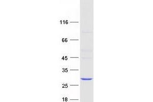 Validation with Western Blot