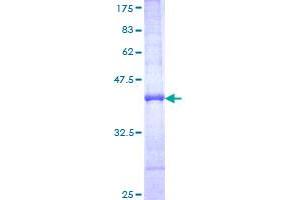 Plectin (PLEC) (AA 4384-4493) protein (GST tag)