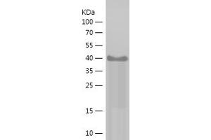 Western Blotting (WB) image for Tumor Protein P63 (TP63) (AA 1-200) protein (His-IF2DI Tag) (ABIN7125563)