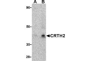 Western blot analysis of CRTH2 in human heart tissue lysate with CRTH2 antibody at (A) 1 and (B) 2 µg/mL. (Prostaglandin D2 Receptor 2 (PTGDR2) (Middle Region) anticorps)