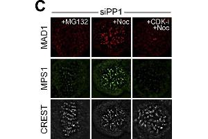 PP2A-B55 counteracts CDK1-dependent MPS1 localization to kinetochores and checkpoint signaling.