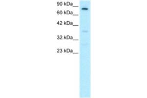 Western Blotting (WB) image for anti-Forkhead Box E3 (FOXE3) antibody (ABIN2460421) (FOXE3 anticorps)