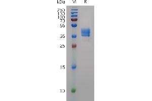 Mouse Protein, hFc Tag on SDS-PAGE under reducing condition.
