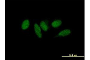 Immunofluorescence of purified MaxPab antibody to MED9 on HeLa cell. (MED9 anticorps  (AA 1-146))