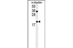 CCDC12 Antibody (N-term) (ABIN657883 and ABIN2846838) western blot analysis in mouse bladder tissue lysates (15 μg/lane). (CCDC12 anticorps  (N-Term))