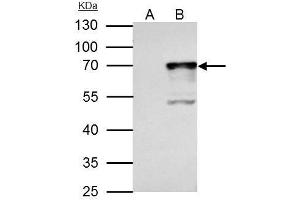 IP Image NRF1 antibody immunoprecipitates NRF1 protein in IP experiments.