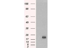 HEK293 overexpressing BAALC (ABIN5339300) and probed with ABIN334357 (mock transfection in first lane). (BAALC anticorps  (Internal Region))