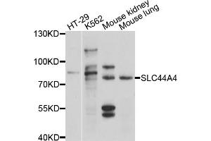 Western blot analysis of extracts of various cell lines, using SLC44A4 antibody (ABIN4905203) at 1:1000 dilution. (SLC44A4 anticorps)