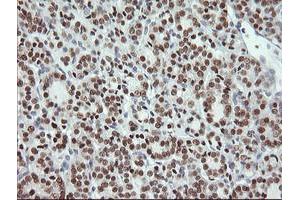 Image no. 2 for anti-Musashi Homolog 1 (Drosophila) (MSI1) antibody (ABIN1499573)