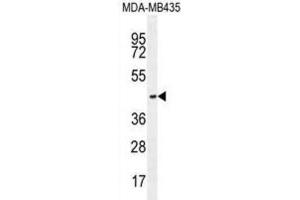 Western Blotting (WB) image for anti-Olfactory Receptor, Family 2, Subfamily L, Member 13 (OR2L13) antibody (ABIN2996118) (OR2L13 anticorps)