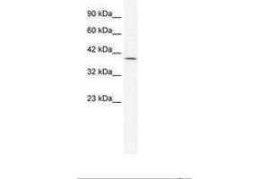 Image no. 1 for anti-Gastrulation Brain Homeo Box 2 (GBX2) (AA 181-230) antibody (ABIN202301) (GBX2 anticorps  (AA 181-230))
