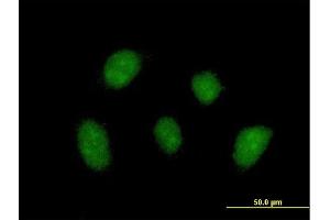 Immunofluorescence of purified MaxPab antibody to ZNF710 on HeLa cell. (ZNF710 anticorps  (AA 1-664))