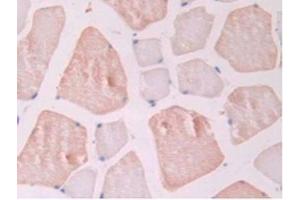 IHC-P analysis of Rat Skeletal Muscle Tissue, with DAB staining. (Endoglin anticorps  (AA 26-136))
