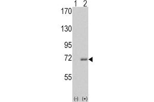 Western blot analysis of IRAK1 (arrow) using rabbit polyclonal IRAK Antibody (C-term). (IRAK1 anticorps)