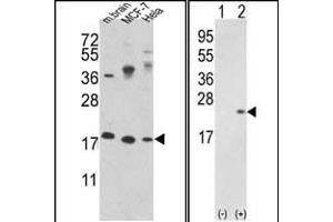 Western blot analysis of CFL1 Antibody (N-term) (ABIN389443 and ABIN2839515) in MCF-7,Hela cell line and mouse brain tissue lysates (35 μg/lane). (Cofilin anticorps  (N-Term))