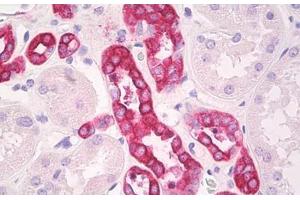 Image no. 2 for anti-Arginine Vasopressin Receptor 2 (AVPR2) (C-Term) antibody (ABIN1492332) (AVPR2 anticorps  (C-Term))