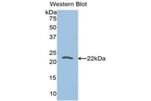 Western Blotting (WB) image for anti-Tumor Protein, Translationally-Controlled 1 (TPT1) (AA 1-172) antibody (ABIN5662059) (TPT1 anticorps  (AA 1-172))