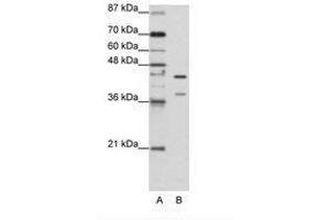 Image no. 2 for anti-Heterogeneous Nuclear Ribonucleoprotein K (HNRNPK) (AA 371-420) antibody (ABIN203155) (HNRNPK anticorps  (AA 371-420))