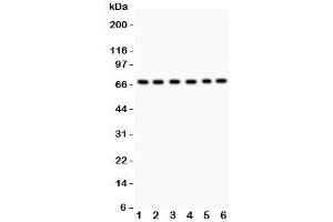 Western blot testing of PKC iota antibody and Lane 1:  SHG-44;  2: A549;  3: U87;  4: 293T;  5: HeLa;  6: Jurkat. (PKC iota anticorps  (AA 21-214))