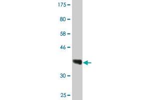 Western Blot detection against Immunogen (36. (RPRD1A anticorps  (AA 76-170))