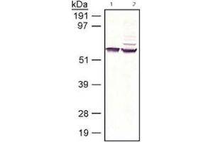 RPE65 detected in bovine and human samples using RPE65 monoclonal antibody, clone 401.