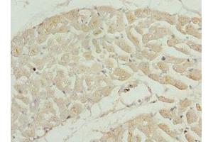 Immunohistochemistry of paraffin-embedded human heart tissue using ABIN7173581 at dilution of 1:100 (TNNI2 anticorps  (AA 1-100))