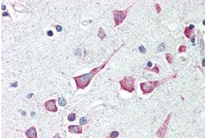 Human Brain, Cortex (formalin-fixed, paraffin-embedded) stained with DAPK3 antibody ABIN214482 at 2. (DAPK3 anticorps  (Internal Region))