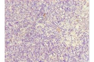 Immunohistochemistry of paraffin-embedded human thymus tissue using ABIN7169185 at dilution of 1:100 (SIK3 anticorps  (AA 60-310))