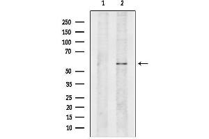 Western blot analysis of lysates from Myeloma cells, using APPBP1 Antibody.