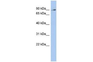 WB Suggested Anti-ZNF711 Antibody Titration:  0. (ZNF711 anticorps  (N-Term))