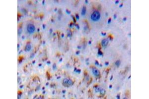 IHC-P analysis of Liver tissue, with DAB staining. (HFE2 anticorps  (AA 29-401))
