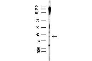 Western blot analysis of lysates from COLO205 cells(heat-shock,45 min treatment), using Phospho-Casein Kinase 1 alpha (Tyr294) Antibody at 1/1000 dilution.