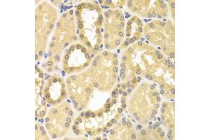 Immunohistochemistry of paraffin-embedded human kidney using IDE antibody at dilution of 1:100 (x400 lens). (IDE anticorps)