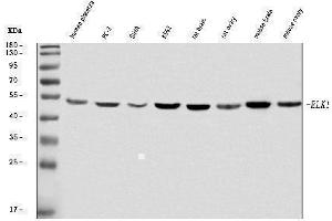 Western blot analysis of ELK1 using anti-ELK1 antibody (ABIN7601628).